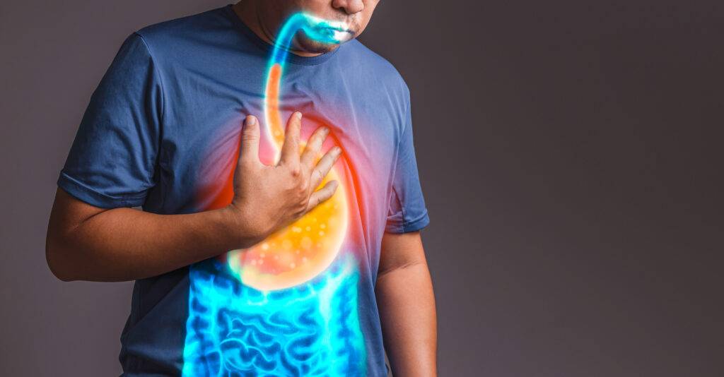 TOP 6 Vitamins and Supplements you NEED to stop ACID REFLUX